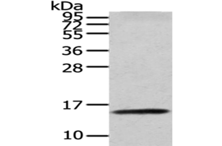 CDA Antibody from Signalway Antibody (43016) - Antibodies.com