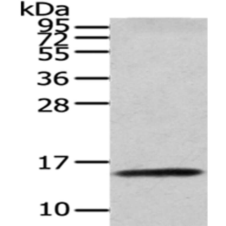 CDA Antibody from Signalway Antibody (43016) - Antibodies.com