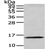 CDA Antibody from Signalway Antibody (43016) - Antibodies.com