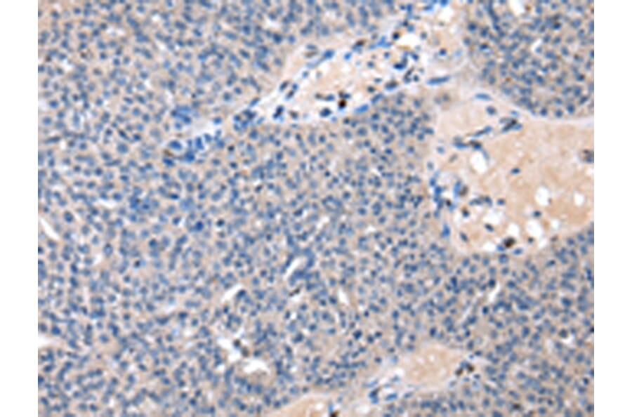 Immunohistochemistry - CDA Antibody from Signalway Antibody (43016) - Antibodies.com
