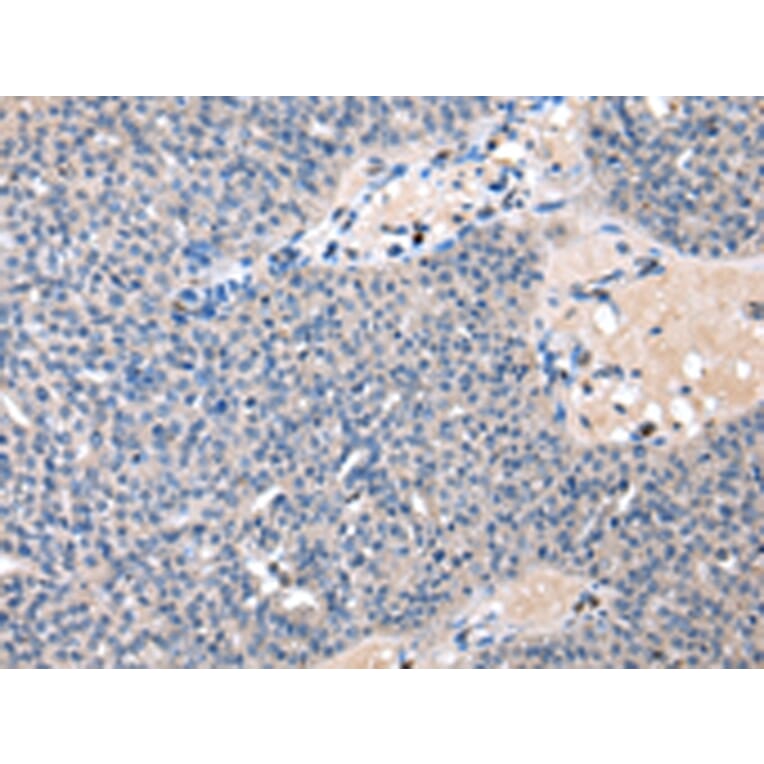 Immunohistochemistry - CDA Antibody from Signalway Antibody (43016) - Antibodies.com