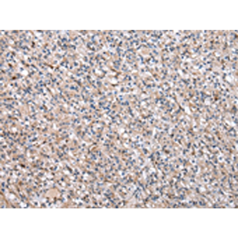 Immunohistochemistry - CDA Antibody from Signalway Antibody (43016) - Antibodies.com