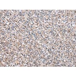 Immunohistochemistry - CDA Antibody from Signalway Antibody (43016) - Antibodies.com