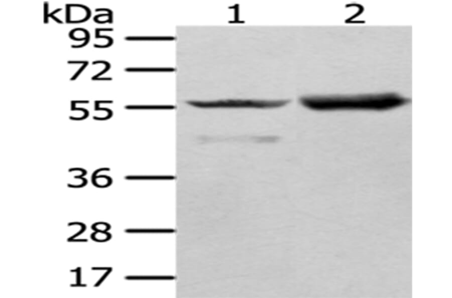 FGR Antibody from Signalway Antibody (43018) - Antibodies.com