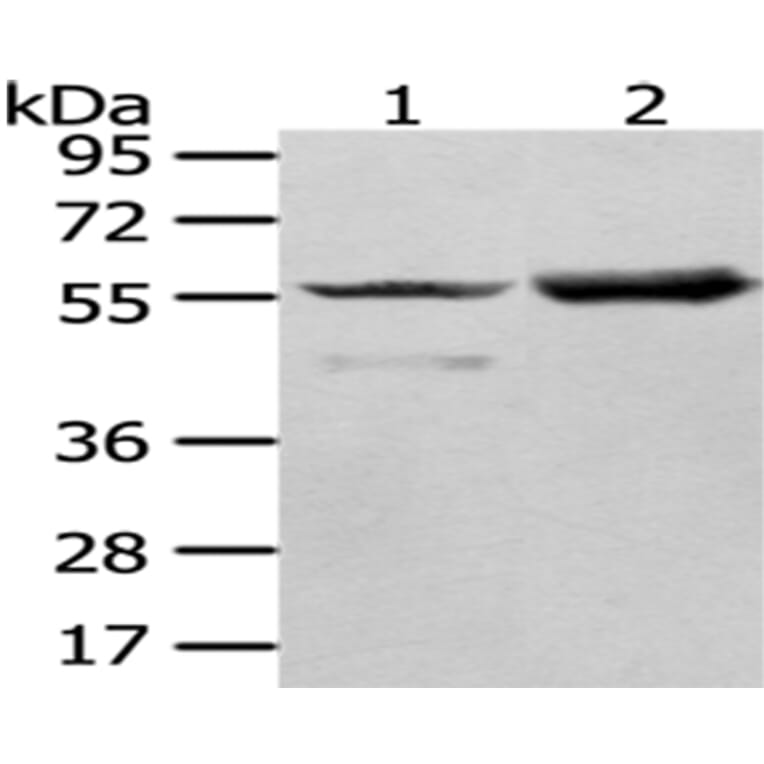 FGR Antibody from Signalway Antibody (43018) - Antibodies.com