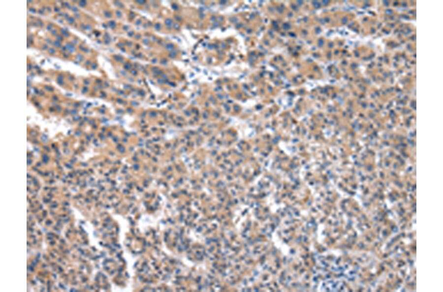 Immunohistochemistry - FGR Antibody from Signalway Antibody (43018) - Antibodies.com