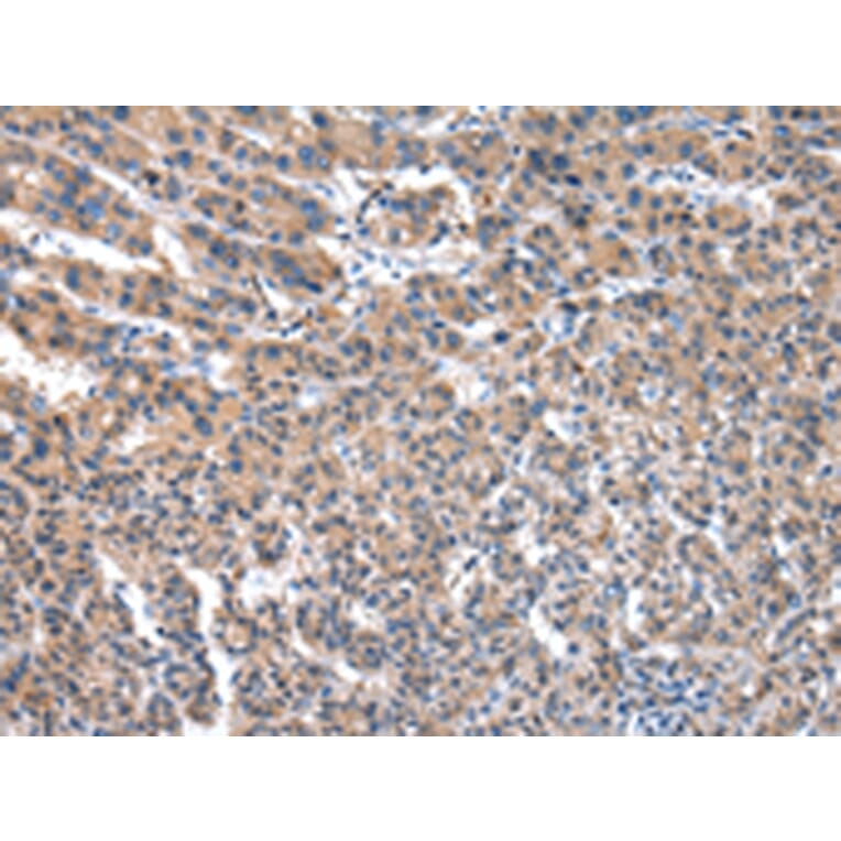 Immunohistochemistry - FGR Antibody from Signalway Antibody (43018) - Antibodies.com