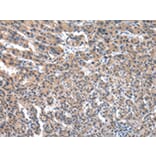 Immunohistochemistry - FGR Antibody from Signalway Antibody (43018) - Antibodies.com