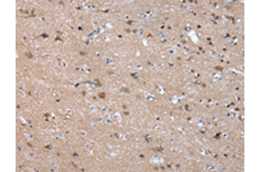 Immunohistochemistry - FGR Antibody from Signalway Antibody (43018) - Antibodies.com