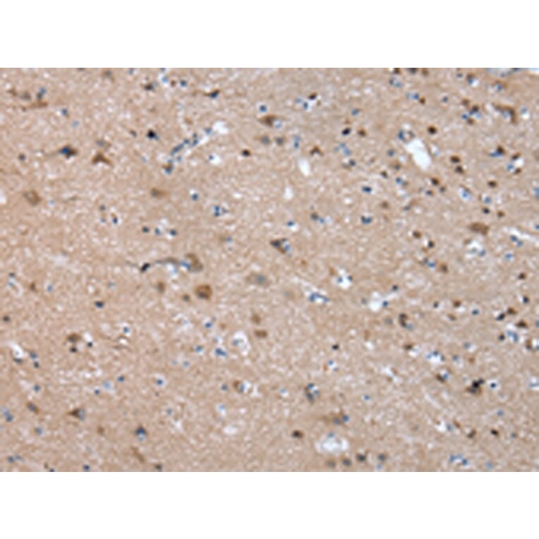 Immunohistochemistry - FGR Antibody from Signalway Antibody (43018) - Antibodies.com