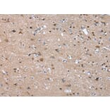 Immunohistochemistry - FGR Antibody from Signalway Antibody (43018) - Antibodies.com