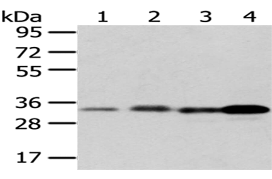 ESD Antibody from Signalway Antibody (43048) - Antibodies.com
