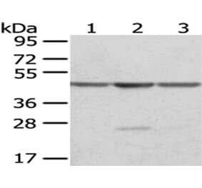 OAT Antibody from Signalway Antibody (43049) - Antibodies.com