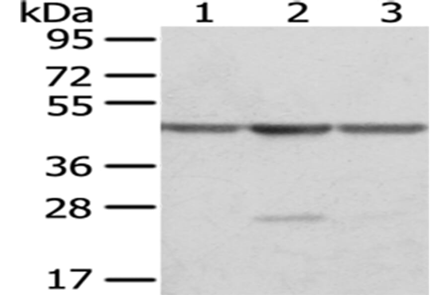 OAT Antibody from Signalway Antibody (43049) - Antibodies.com