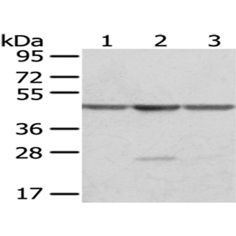 OAT Antibody from Signalway Antibody (43049) - Antibodies.com