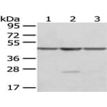 OAT Antibody from Signalway Antibody (43049) - Antibodies.com