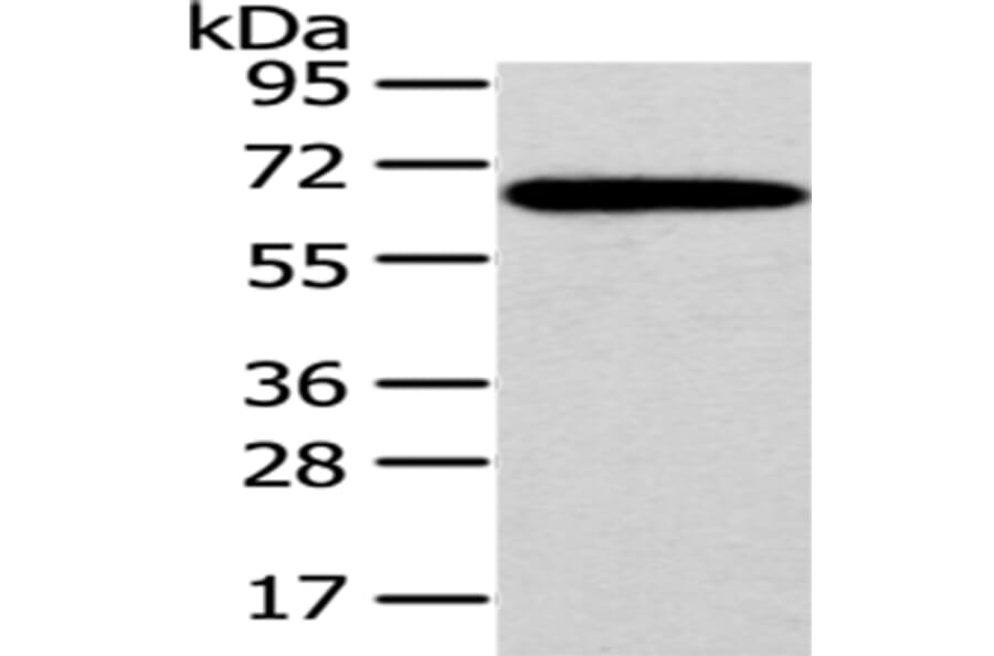 SF1 Antibody from Signalway Antibody (43060) - Antibodies.com