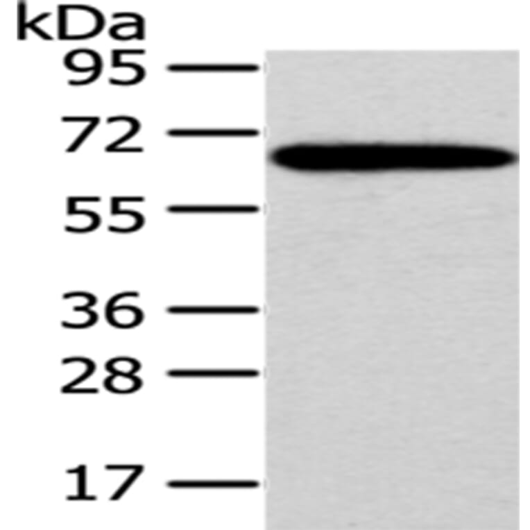SF1 Antibody from Signalway Antibody (43060) - Antibodies.com