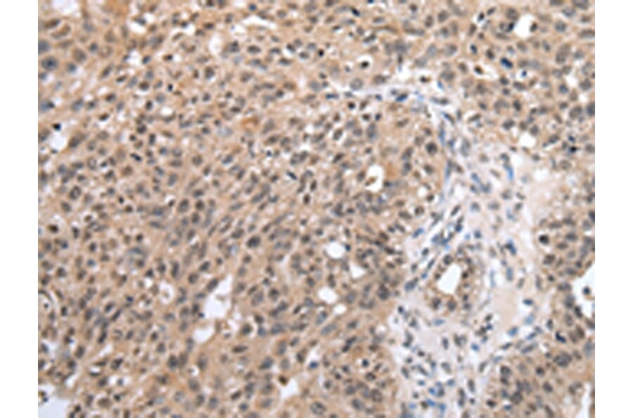 Immunohistochemistry - SF1 Antibody from Signalway Antibody (43060) - Antibodies.com
