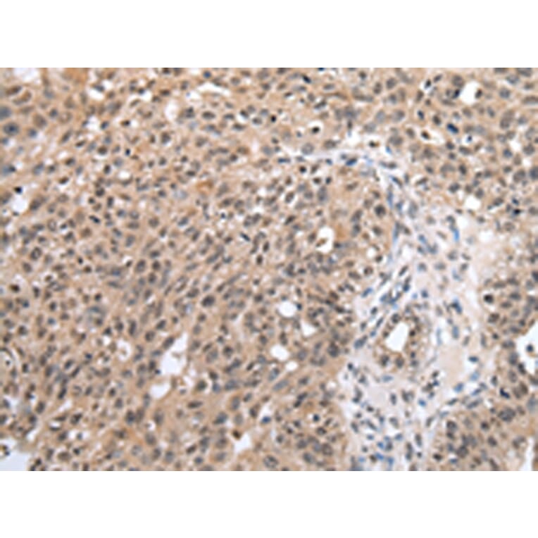 Immunohistochemistry - SF1 Antibody from Signalway Antibody (43060) - Antibodies.com