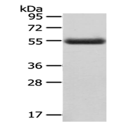 CPM Antibody from Signalway Antibody (43071) - Antibodies.com