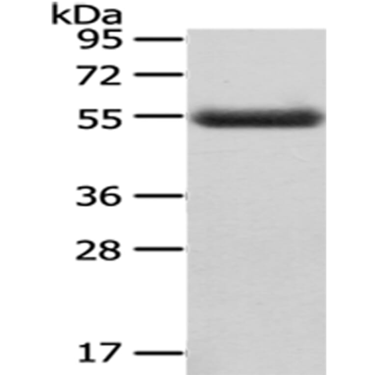 CPM Antibody from Signalway Antibody (43071) - Antibodies.com