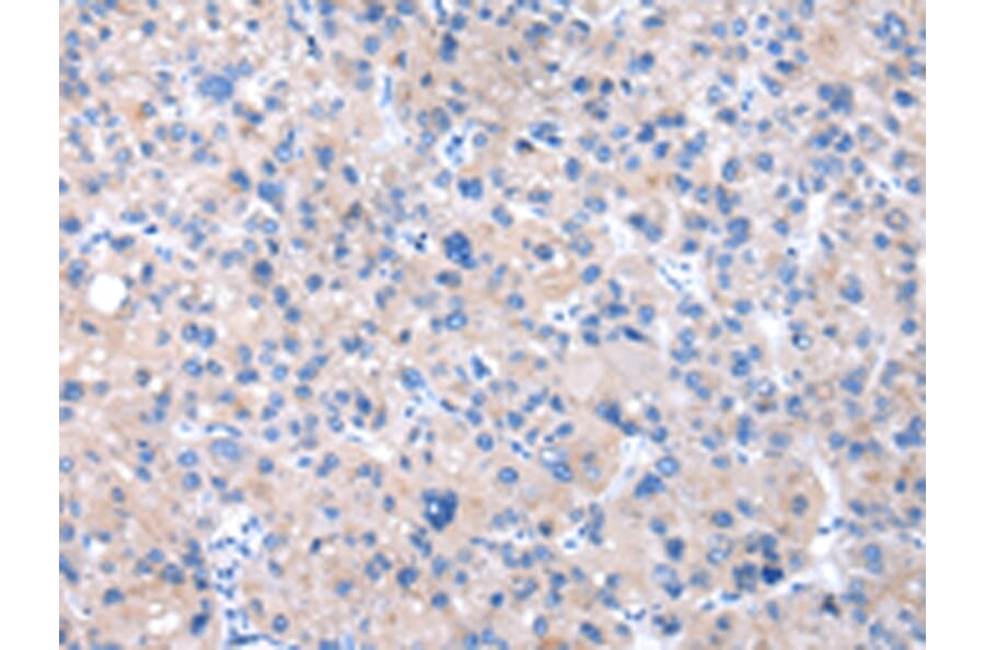 Immunohistochemistry - CPM Antibody from Signalway Antibody (43071) - Antibodies.com