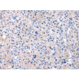 Immunohistochemistry - CPM Antibody from Signalway Antibody (43071) - Antibodies.com