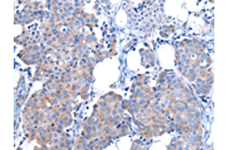 Immunohistochemistry - CPM Antibody from Signalway Antibody (43071) - Antibodies.com
