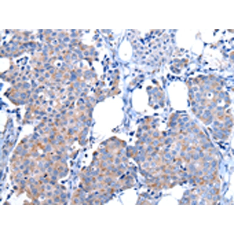 Immunohistochemistry - CPM Antibody from Signalway Antibody (43071) - Antibodies.com