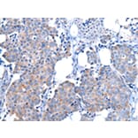 Immunohistochemistry - CPM Antibody from Signalway Antibody (43071) - Antibodies.com