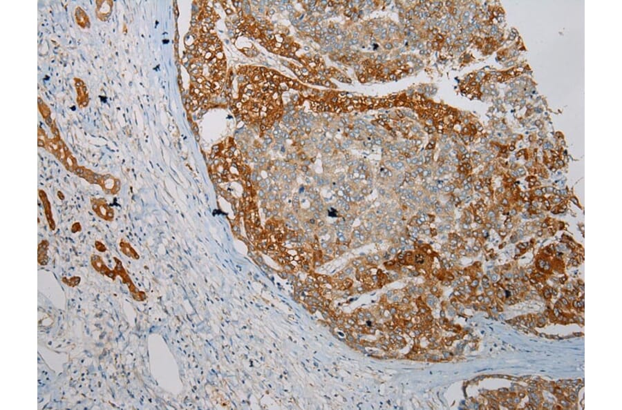 Immunohistochemistry - HGD Antibody from Signalway Antibody (43078) - Antibodies.com