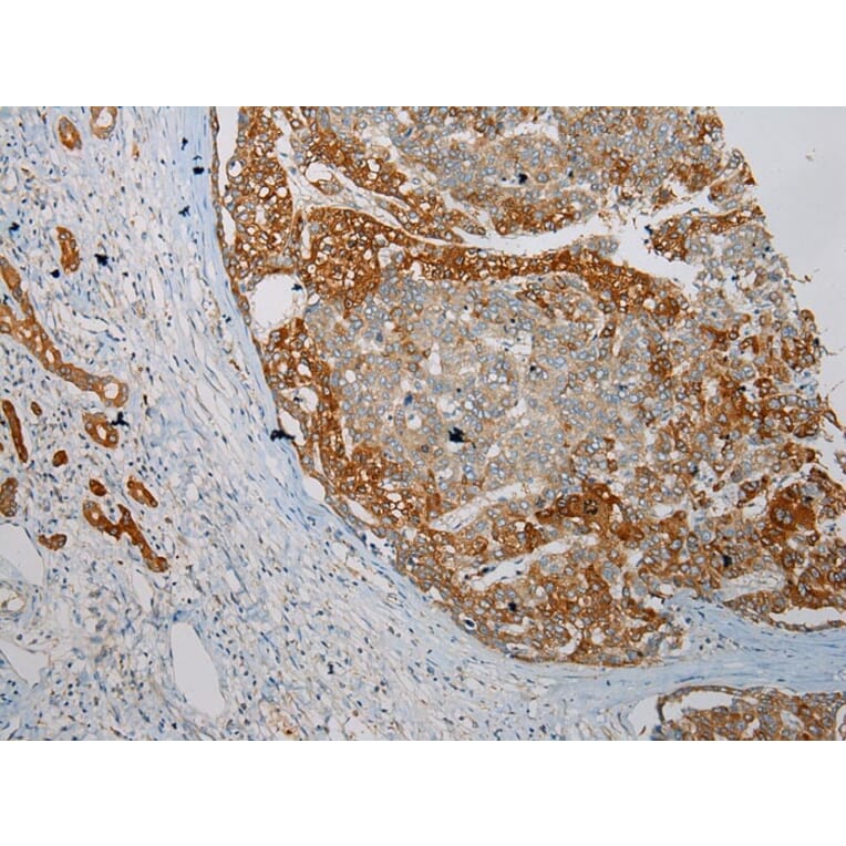 Immunohistochemistry - HGD Antibody from Signalway Antibody (43078) - Antibodies.com