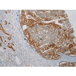 Immunohistochemistry - HGD Antibody from Signalway Antibody (43078) - Antibodies.com