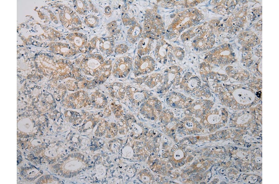 Immunohistochemistry - HGD Antibody from Signalway Antibody (43078) - Antibodies.com