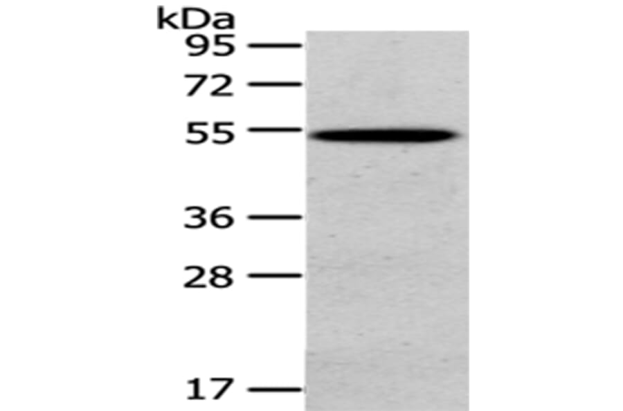 HGD Antibody from Signalway Antibody (43078) - Antibodies.com
