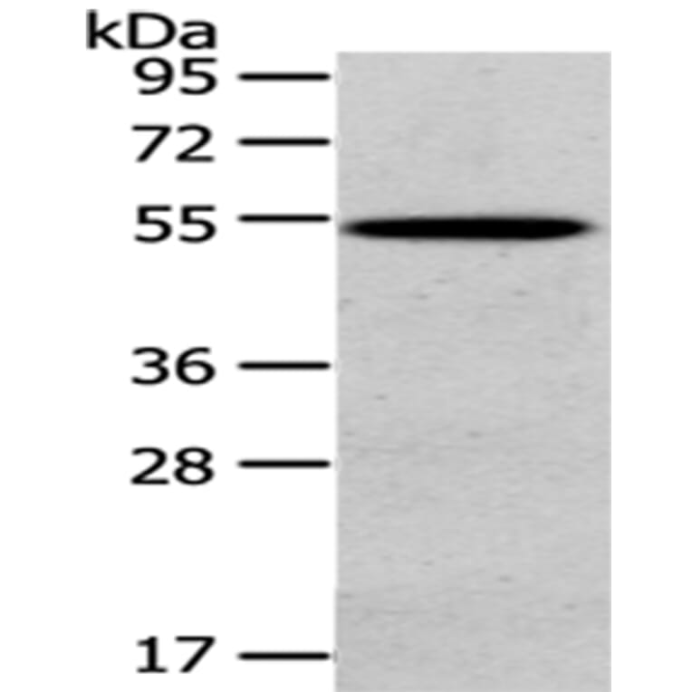 HGD Antibody from Signalway Antibody (43078) - Antibodies.com