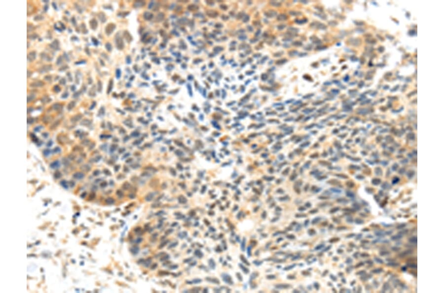 Immunohistochemistry - MET Antibody from Signalway Antibody (43106) - Antibodies.com
