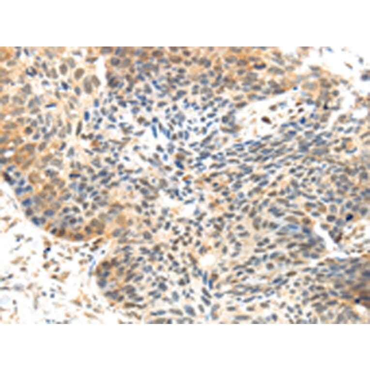 Immunohistochemistry - MET Antibody from Signalway Antibody (43106) - Antibodies.com