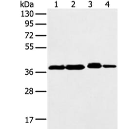 DCX Antibody from Signalway Antibody (43298) - Antibodies.com