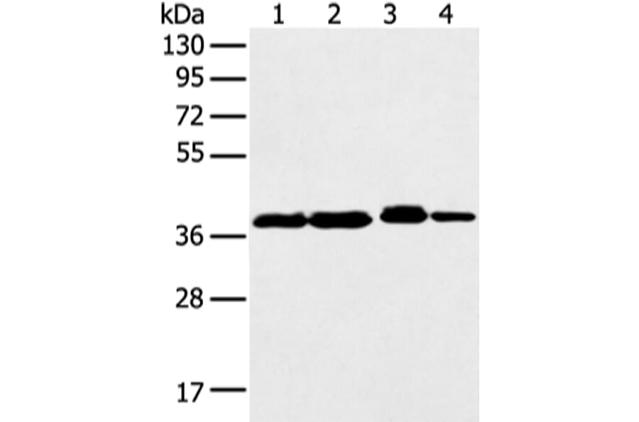DCX Antibody from Signalway Antibody (43298) - Antibodies.com