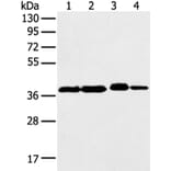 DCX Antibody from Signalway Antibody (43298) - Antibodies.com