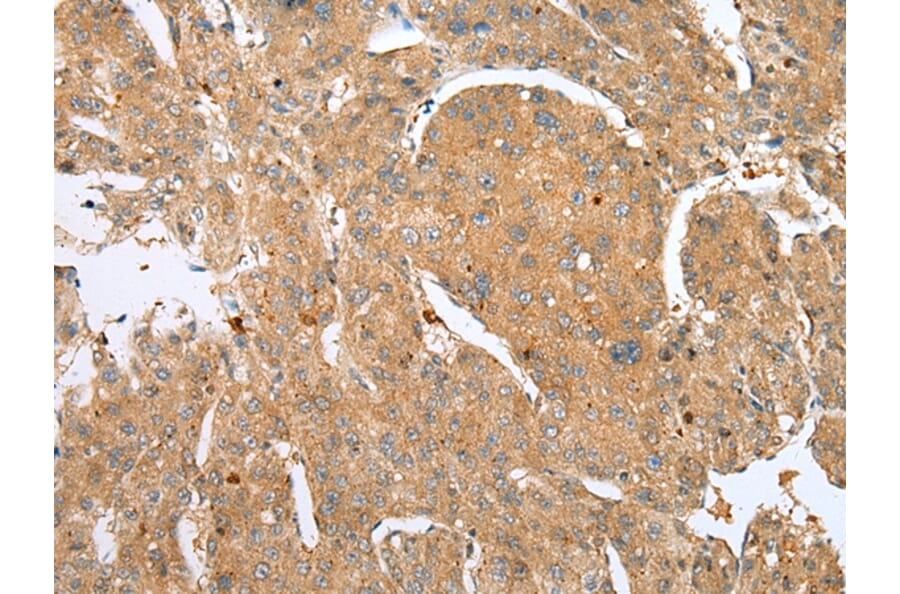 Immunohistochemistry - DCX Antibody from Signalway Antibody (43298) - Antibodies.com