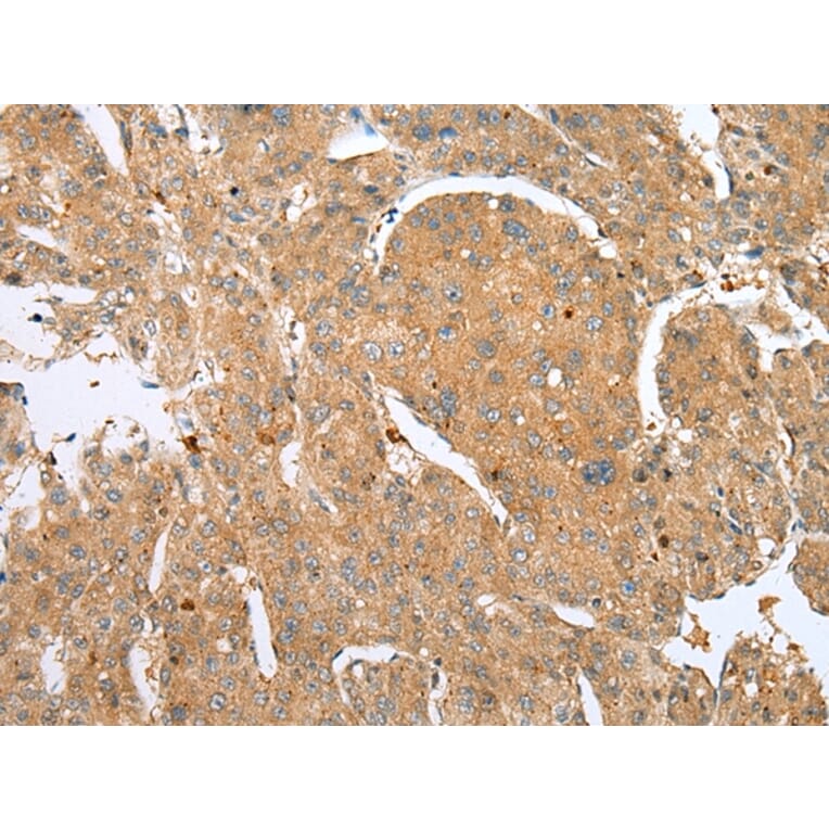 Immunohistochemistry - DCX Antibody from Signalway Antibody (43298) - Antibodies.com