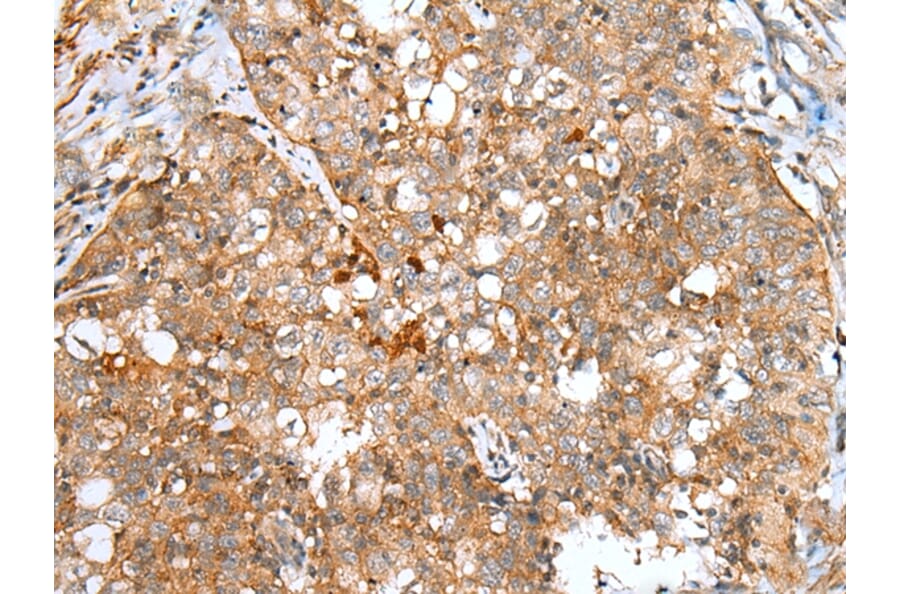 Immunohistochemistry - DCX Antibody from Signalway Antibody (43298) - Antibodies.com
