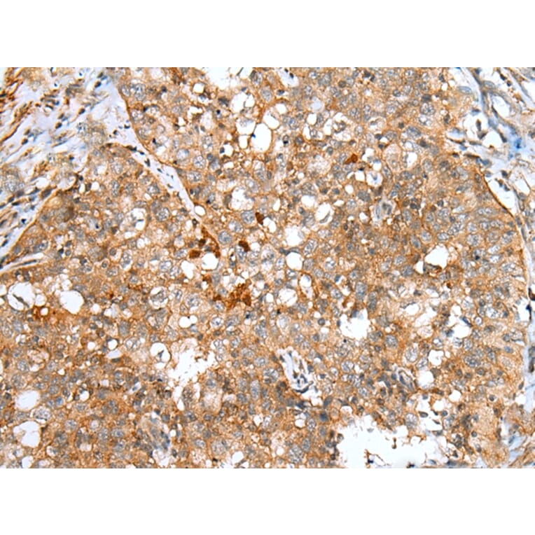 Immunohistochemistry - DCX Antibody from Signalway Antibody (43298) - Antibodies.com