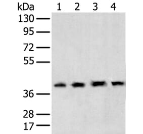 TBP Antibody from Signalway Antibody (43335) - Antibodies.com