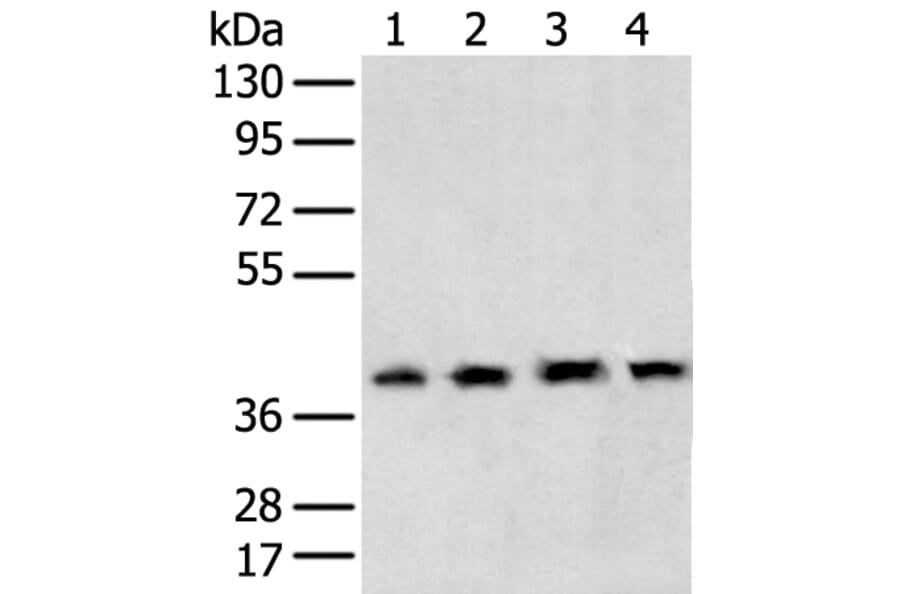 TBP Antibody from Signalway Antibody (43335) - Antibodies.com