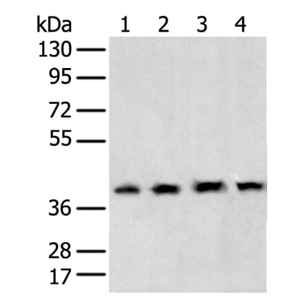 TBP Antibody from Signalway Antibody (43335) - Antibodies.com