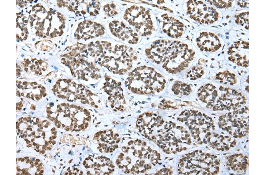 Immunohistochemistry - TBP Antibody from Signalway Antibody (43335) - Antibodies.com